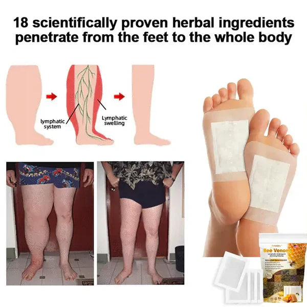 Order 1 Get 1 Free Bee Venom Lymphatic Drainage & Slimming Foot Patches (Pack of 10+10)